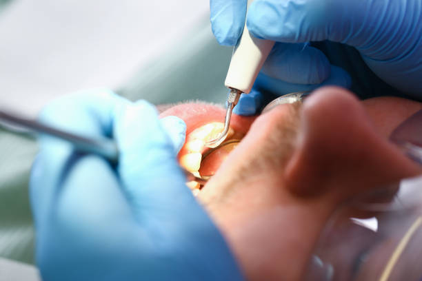 Best Emergency Dental Care for Sports Injuries in West Lake Hills, TX